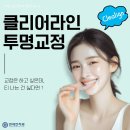 미소라인치과기공소 | 클리어라인 투명교정 (Clealign) 티 안 나는 교정, 연세진치과 자체 기공소로 더 정밀하게