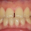 선치과기공소 이미지