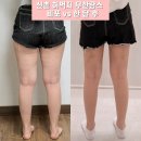 오렌지라인 | 예신관리| 신촌 허벅지 무한람스 1달차 후기 / 부피감 감소 및 라인 변화 체감 + 후관리(오렌지케어)