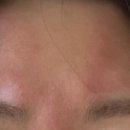 아띠의원 이미지