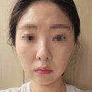 루이뷰티 - 안산시 단원구 고잔로 54 | 안산 루이뷰티 물광꿀광 피부관리 후기