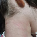 강림 온누리 약국 | 채채피부는 소중하니까 큐어베이비 &#39;아토크림&#39;