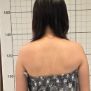 바른몸애 | [서울/서초] 방배피부관리 승모근 관리 전후 비교 체험, 바른몸애 방배점 후기