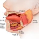 볼거리 유행성이하선염 원인 전염 격리 이미지