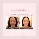약손스킨케어
