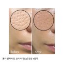 소이당한의원 | 용카 옵티마이저 세럼으로 4주 만에 아기 피부 완성! 모공 수축 리얼 후기
