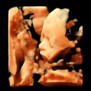 이대약국 | 이대서울병원 산부인과 | 23주 임당검사(금식X)·정밀초음파 후기