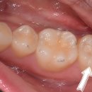 정도치과기공소 이미지