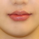 르에이치의원 이미지