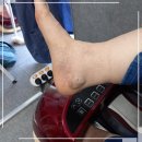 비고르바른건강핫톡 | 구미봉곡동고주파발체온기 비고르바른건강 구미점에서 체험해보고 건강지키기