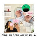 명동에스테틱 은은한결 O2 글로우 스킨케어: 아쿠아필 라라필 후기
