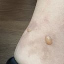 열린문외과의원 이미지