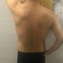 미강세탁 | 리유한의원 남자 등드름 미강약침 신사점에서 받은 후기