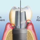 네오치과기공소 이미지