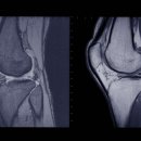 광주중앙영상의학과의원 이미지