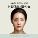 남부-여천-여천10 | 눈밑다크서클시술 한 번으로 10년 어려지는 방법