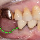 바로세움치과의원 이미지