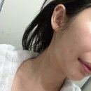 베스트샷 | [듀얼소닉 맥시멈] 3회 이상 사용 리얼후기/ 무제한 샷. 가정용 피부관리기 베스트!