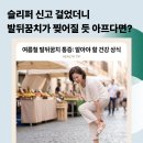 2020-682 | 슬리퍼 신고 걸은 뒤 발뒤꿈치가 찢어질 듯 아프다면?