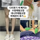 인계동 영광아파트앞 | 인계동 대나무체형교정으로 하체라인 정리 해봤어요, 붓기가 싹!