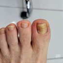 부천북초등학교 | 부천내성발톱 샵라움 부천무좀발톱관리 받았어요