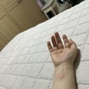 신학철피부과의원 | [면역력 저하] 급성 두드러기