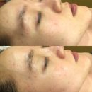 미가스킨케어 이미지