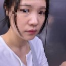 메이텐 | [뷰티] 명동 피부과에서 고현정 리프팅으로 유명한 '텐트리플' 받은 후기 (2주 후 효과비교)