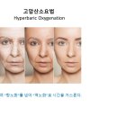 ["고압산소치료요법 Hyperbaric Oxygenation"] 암치료, 노화방지, 피부재생 / 리업필라테스 이미지