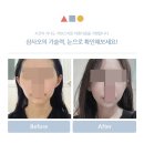 삼사오성형외과의원 이미지