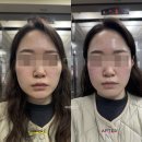 끌리메 김해 다이어트 페이스 트레이닝&amp;바디 컨투어 페이스관리 후기