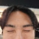 차부약국 | 수원역피부과 남자슈링크보톡스 상담, 시술 후기