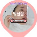 세라 유치원 | [제천 피부관리] 3세대 세라링 후기와 부작용 - 빛날율