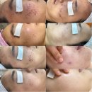 세모메디칼 | 오랜만에 다녀온 고아진에스테틱에서 얼테기 임산부 “탕후루케어”받은 후기 (feat. 🤰)