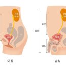 여성에게 흔한 질병 방광염, 방치하지 마세요! 이미지