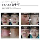 바로바로의원 이미지