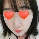 운남피부과의원 | 레이저리프팅후기 / 울트라스킨으로 효과짱짱!!