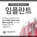 하얀고운치과의원 네이버블로그