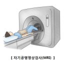 아킬레스 건염[Achilles&#39; tendonitis근골격질환] 이미지