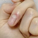 광화문헤리티크피부과의원 네이버블로그