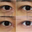 강남미의원 이미지