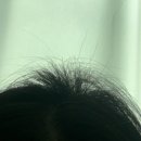 성도한의원 | 정신나간 직장인의 정신 되찾기 대모험 (feat. 불안장애, 우울증)