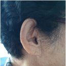 금천독일맑은보청기 이미지