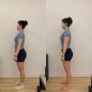 평촌부부한의원 | [공지] 평촌필라테스 | 별앤필라테스 1회 수업만으로 골반 전방경사 교정? (비포애프터 확실해요!) ✨