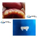 태양치과기공소 이미지