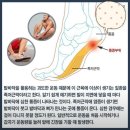 족저근막염 해부하기-발가락운동용구 듀트 이미지