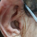 시그니아독일보청기대구북구센터 이미지