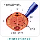 발기부전의 진단......................................서양의학적접근 이미지