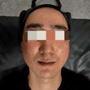 에스알뷰티케어 이미지