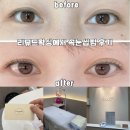리뮤드